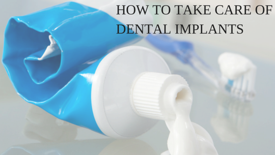 take care of dental implants