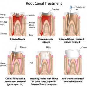 Endodontics