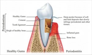 periodontics