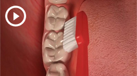 Missing Some Teeth